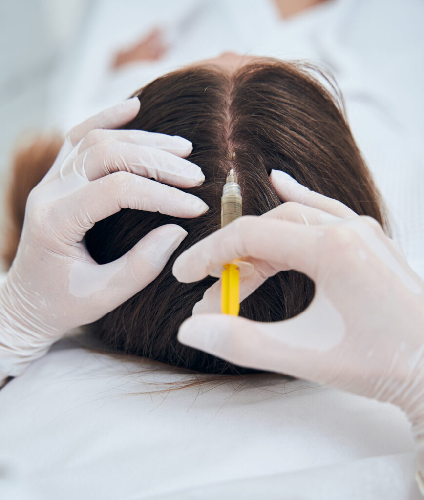 medico realizando inyecciones capilares en paciente