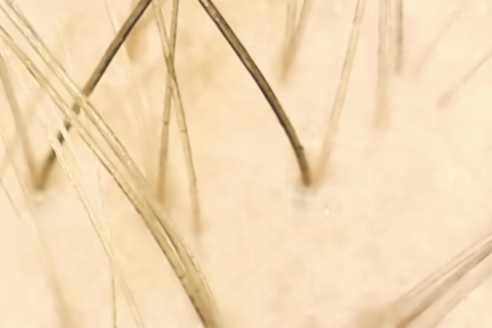 acercamiento del folículo piloso